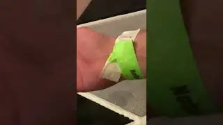 Wristband removal tutorial. 🤣 30+ years of experience.