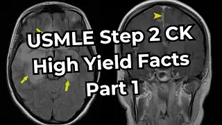 USMLE Step 2 CK High Yield Facts (Part 1)