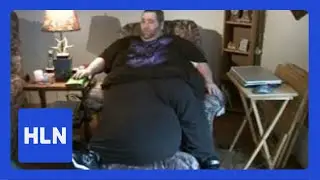 Watch: The man with the 100-lb scrotum