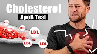 Is Your Cholesterol Test Wrong? (check ApoB Instead)