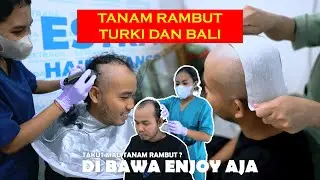 TANAM RAMBUT TERBAIK DI INDONESIA HADIR DI BALI !! | HARGA KAKI LIMA KUALITAS BINTANG 5