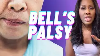 BELL’S PALSY Symptoms, Causes & Treatment! Are you at risk? A Doctor Explains