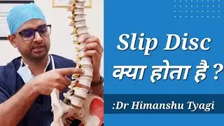 Slip Disc क्या होता है ? (Disc herniation/Disc prolapse/Lumbar PIVD/sciatica/ What is slip disc)