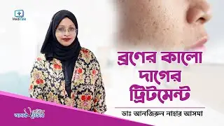 ব্রণ থেকে কালো দাগ দূর হবে যে ট্রিটমেন্টে Acne Spot Removal Treatment