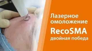 Семейное ОМОЛОЖЕНИЕ: двойная победа / Лазерное омоложение RecoSMA