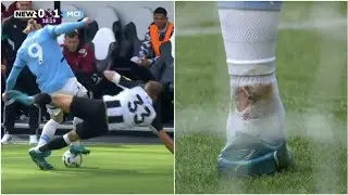 💔 Erling Haaland's ankle after being on the receiving end of a challenge by Newcastle's Dan Burn