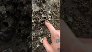 Imagine Being INFESTED With THESE! 
