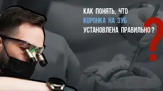 Как понять, что коронка на зуб установлена правильно❓