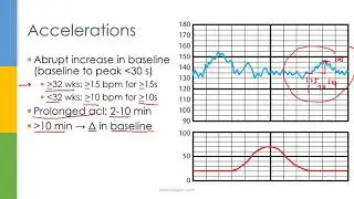 Learn OB/GYN: Fetal Heart Rate Monitoring / Nonstress Test