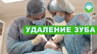 Удаление зуба | Клиника доктора Осиповой