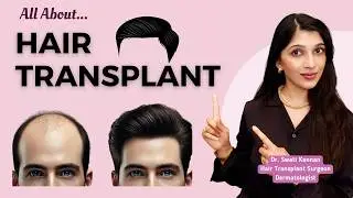 Watch This Before You Get a Hair Transplant: Avoid These Big Mistakes!