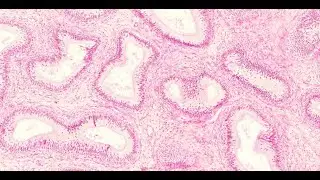 epididymis