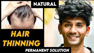 THIN HAIRS TO THICK HAIR At Home Naturally|Stronger & Thicker Hair (बालों को घना मोटा कैसे करे)Hindi