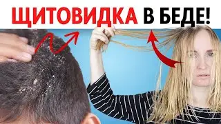 4 проблемы С ВОЛОСАМИ, которые говорят, что ваша щитовидная железа в беде