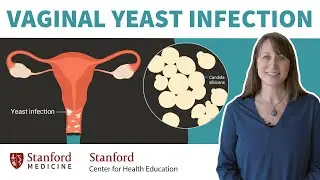 Vaginal yeast infection: Doctor explains causes, symptoms, & treatment | Stanford