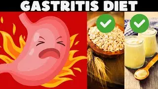 Gastritis Diet| 5  Amazing Foods To Relieve Gastritis Fast At Home |Natural Remedies For Gastritis