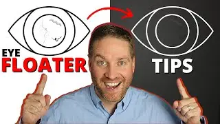 Eye Floaters Help! - 5 Natural Life Hack Remedies For Adapting To Eye Floaters