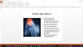Discussion About Photic Entrainment
