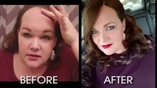 Thin hair to thicker hair| UniWigs hair toppers for hairloss