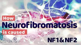 How Neurofibromatosis Type 1 and  Type 2 is caused | NF 1 & NF 2