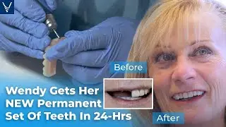 Wendy Gets Her NEW Permanent Set Of Teeth In 24-hours With Dental Implants