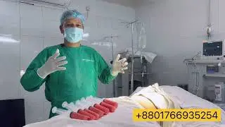 Body contouring | Fat grafting | Liposuction | Dr Iqbal Ahmed | Breast lifting | Hip dips correction