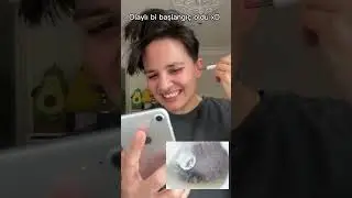 Kameralı kulak temizleme aletini deniyorum i! Ear clean machine 