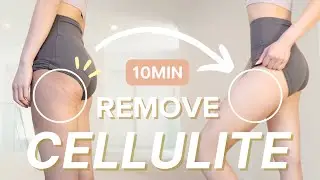 10min Easy Remove Cellulite workout | Burn Thighs & Hips Fat | Fix Hip Dips (100% Result)