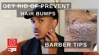 How to Get Rid of Hair Bumps Razor Bumps, Ingrown Hairs or Pseudofolliculitis