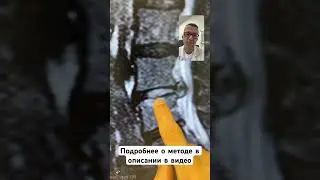 Грыжа диска L5-S1