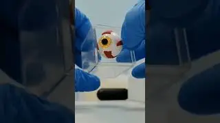 говорит офтальмолог 
