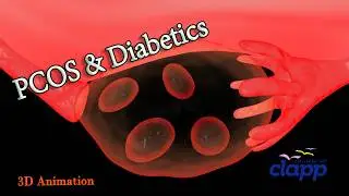 PCOS AND DIABETICS ( 3D Animation )