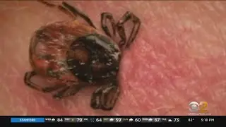 Summer Flu-Like Symptoms May Be Caused By Ticks, Not COVID