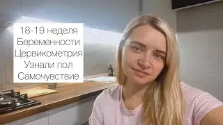 18-19 НЕДЕЛЬ. ЦЕРВИКОМЕТРИЯ. УЗИ УЗНАЛИ ПОЛ. Самочувствие и изменения на работе.