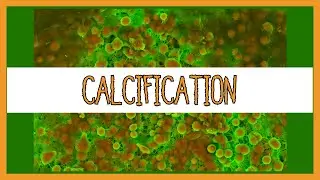 Dystrophic vs. Metastatic Calcification