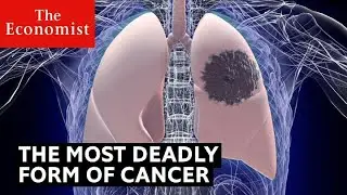 How to detect the deadliest form of cancer