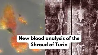 New blood analysis of the Shroud of Turin supports Biblical story!