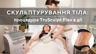 СПОРТИВНИЙ ЖИВІТ - реалізую свою мрію з TRUSCULPT FLEX