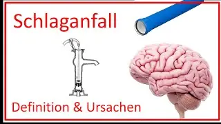 Schlaganfall - Definition und Ursachen