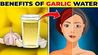 Benefits Of GARLIC For Hair Growth And Skin Care | Healthy Flix