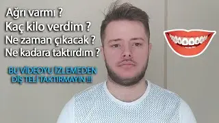 Diş teli taktırdım !!! - Fiyatı ne kadar ? Kaç kilo verdim ?