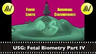 Fetal Biometry Part IV Femur Length & Abdominal Circumference