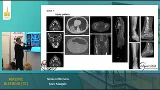 MASSIVE BLEEDING CC     ISICEM 2023