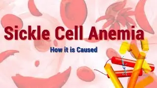 Sickle Cell Anemia | Causes, Symptoms and Molecular Mechanism