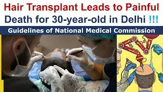 Hair Transplantation Ki---s 30-year-old in Delhi ! Guidelines of National Medical Commission !