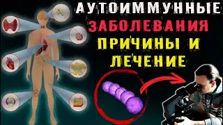 Аутоиммунные заболевания - причины и лечение.