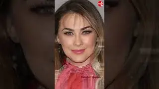 𝗔𝗥𝗔𝗖𝗘𝗟𝗬 𝗔𝗥Á𝗠𝗕𝗨𝗟𝗔⭐Antes y Después 