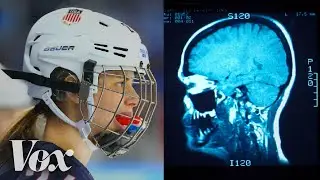 Why women’s ice hockey has a higher concussion rate than football