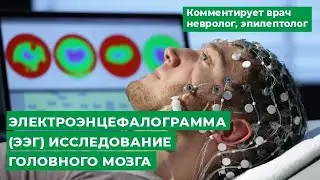 Электроэнцефалограмма (ЭЭГ) исследование головного мозга. Комментирует врач невролог, эпилептолог.