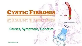 Cystic Fibrosis | a genetic disorder that affects Lungs, pancreas, liver and Kidneys